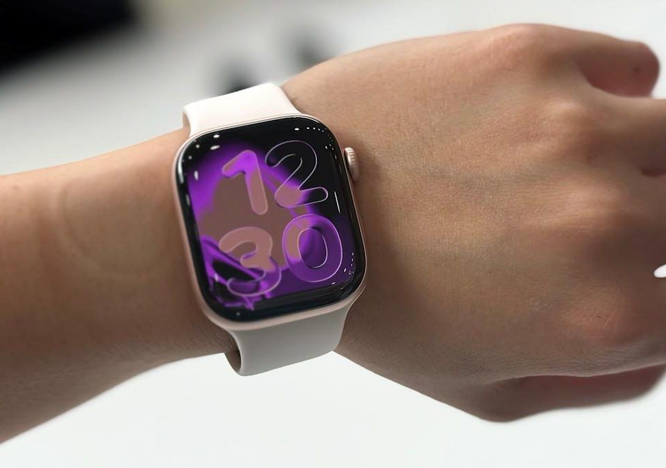 Imagine despre apple watch series - secureitsolutions.ro